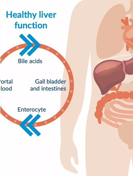 differential-pediatric-cholestatic-video